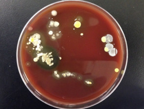 Bacterial culture from forearm