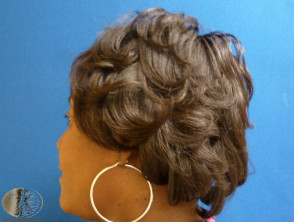 Relaxer used to striaghten hair in woman of African descent