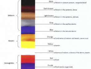 Diagram. Colours in dermatoscopy. From Kittler H et al