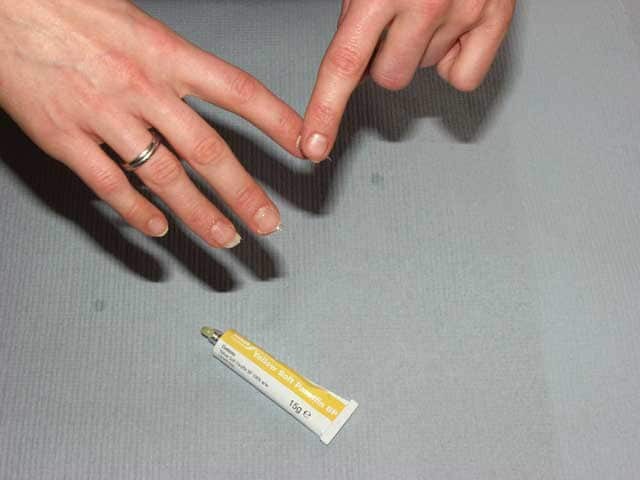 Yellow soft paraffin can be applied to the nails to prevent staining