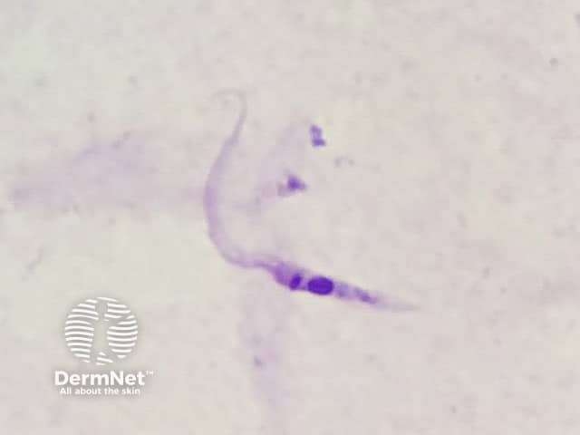 Trypanosoma cruzi epimastigote