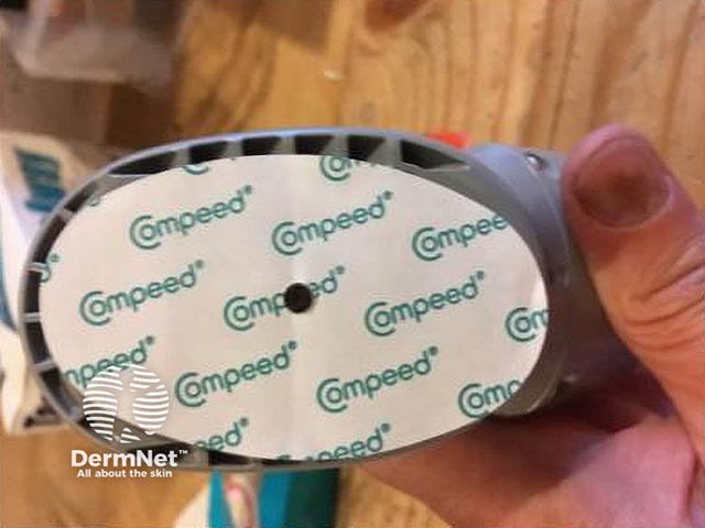 The monitor adhesive patch cover is removed and the barrier dressing applied on top