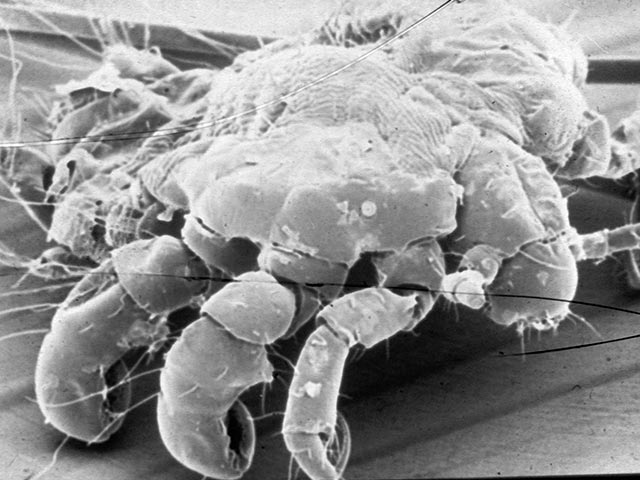 A scanning electron microscope image of a crab louse