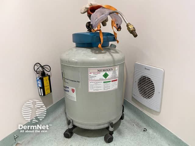 A liquid nitrogen storage vessel - the room is ventilated and has an oxygen monitor. Gloves and goggles are used when filling smaller units for clinic use