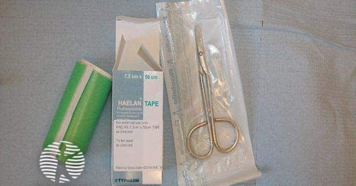 Haelan tape and surgical scissors image
