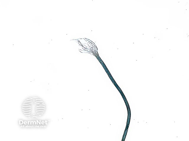Microscopy of a fibre claimed to have been extruded through the skin