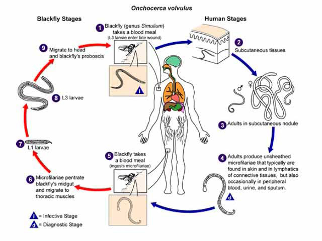 Lifecycle of onchocerciasis
