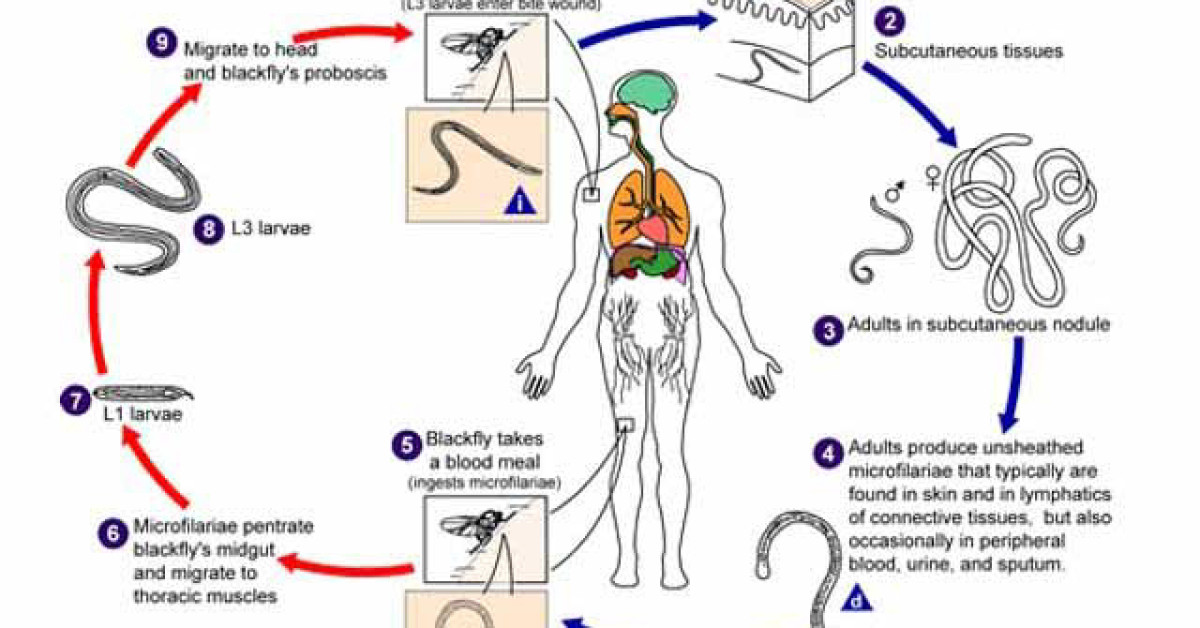 DermNet® - onchocerciasis life cycle image