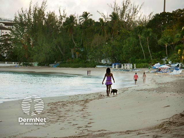 A tropical beach - dogs defaecating in the tidal zone are the cause of most cases of larva migrans