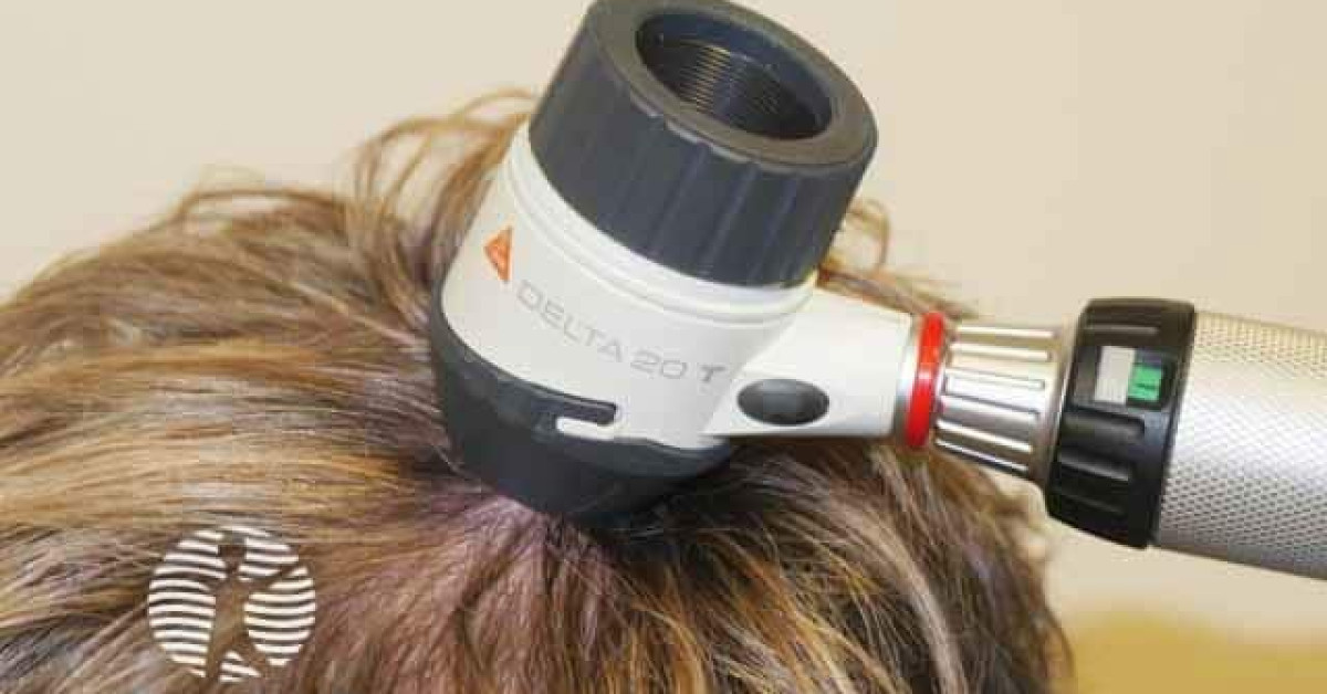 Trichoscopy analogue instrument image