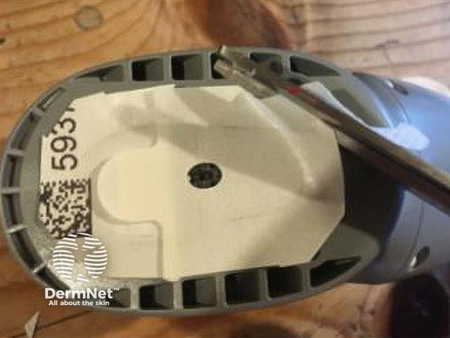 The adhesive patch on the monitor is trimmed leaving it as small as possible for it to adhere to the barrier dressing