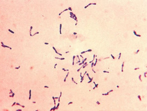 Corynebacterium diphtheriae Gram stain