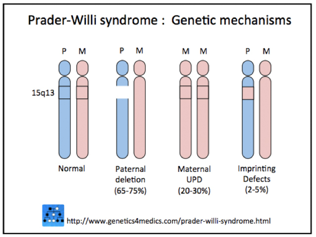 Genetic mechanisms of Prader–Willi syndrome
