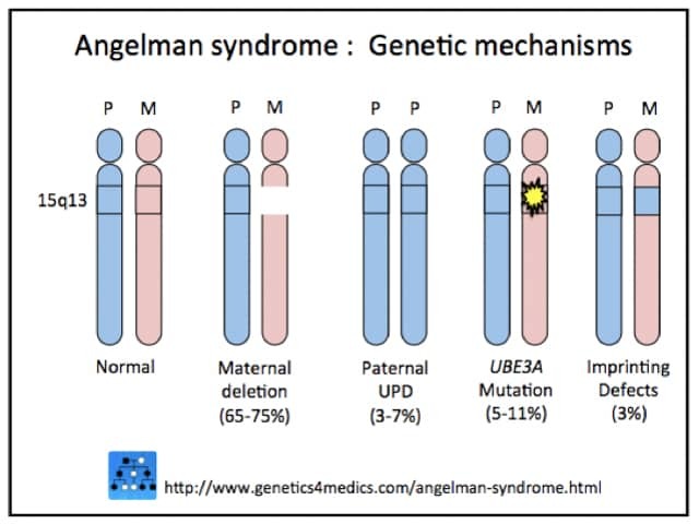 Angelman syndrome genetics*
