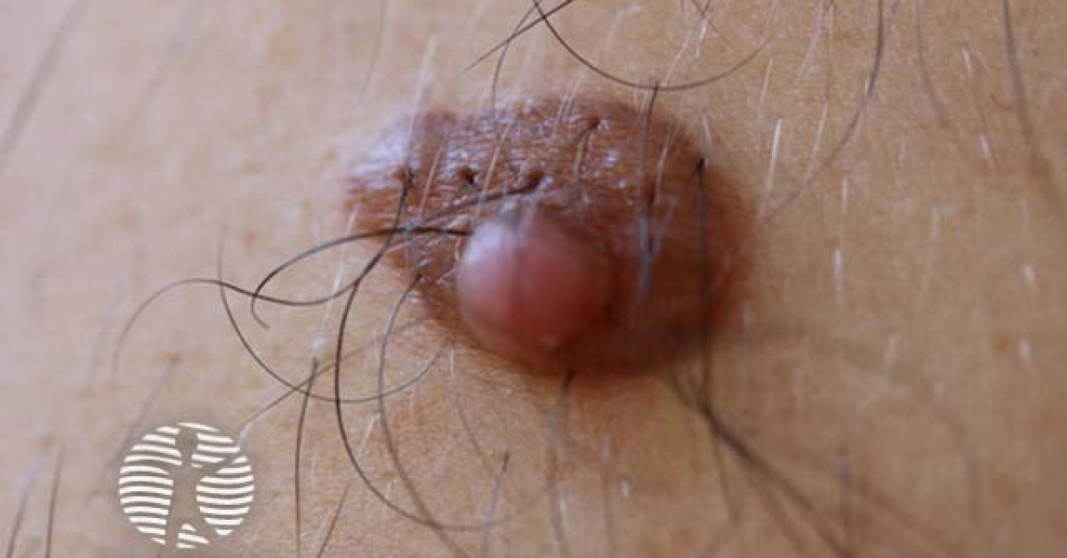 Er-xotin jinsiy aloqa rus