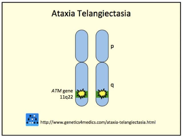 Genetics of ataxia telangiectasia*