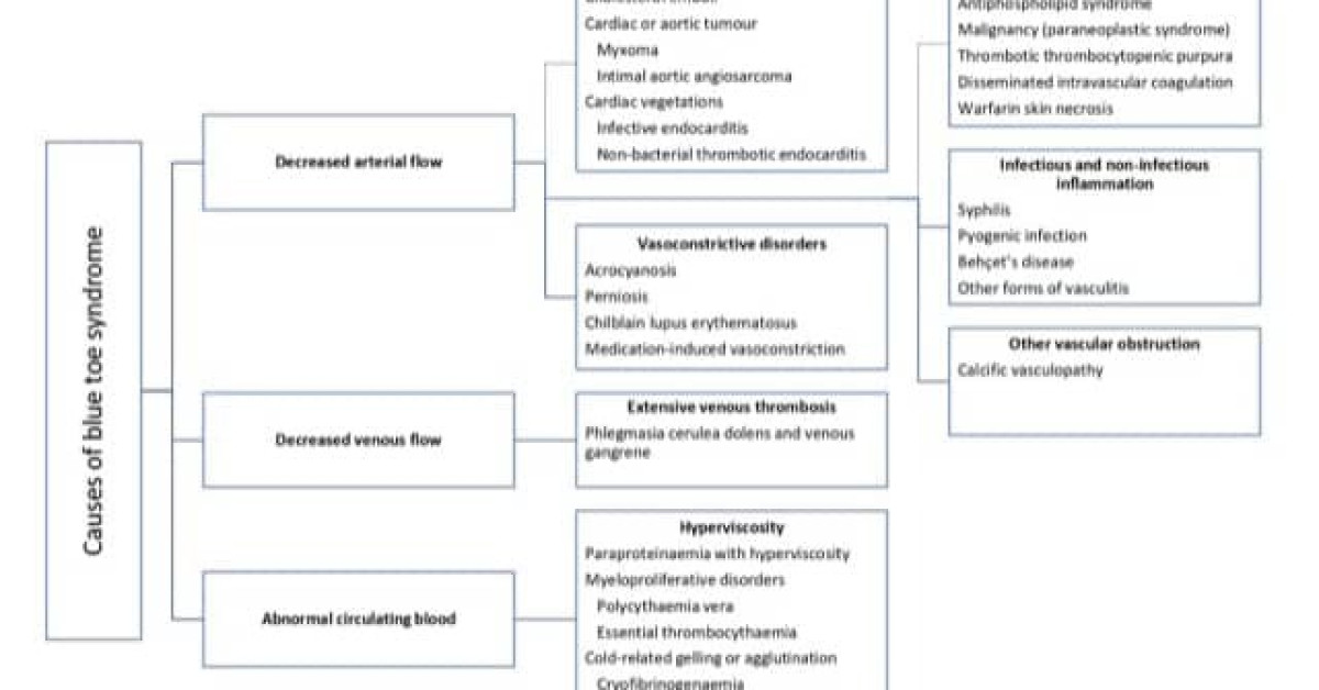 Causes of blue toe syndrome diagram image