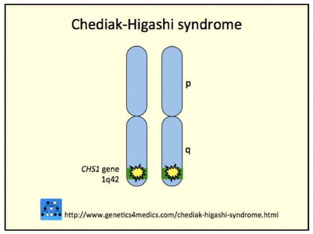 Chediak Higashi syndrome genetics*