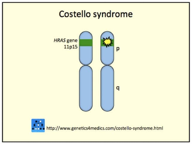 Costello syndrome genetics*