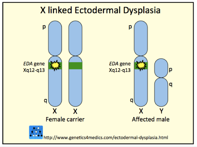 Ectodermal dysplasia genetics*
