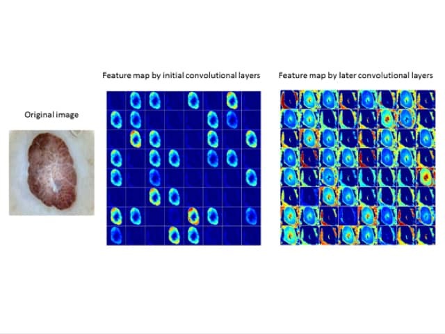 Typical feature maps learned using convolutional neural networks.