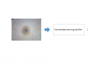 Inference produced by deep learning algorithms on a new image of a skin lesion.