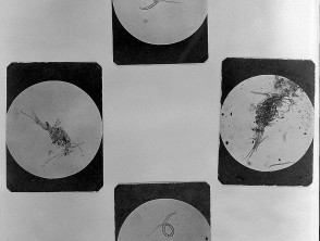 Microphotographs of guinea worm development