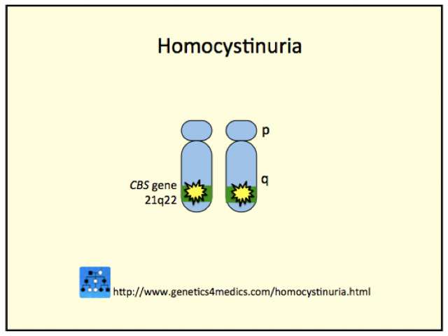 Genetics of Homocystinuria*