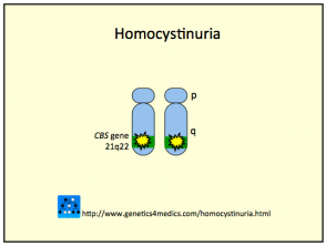 Homocystinuria2