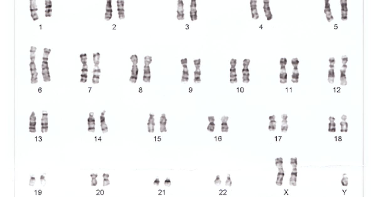 DermNet® - Human chromosomes XXY image