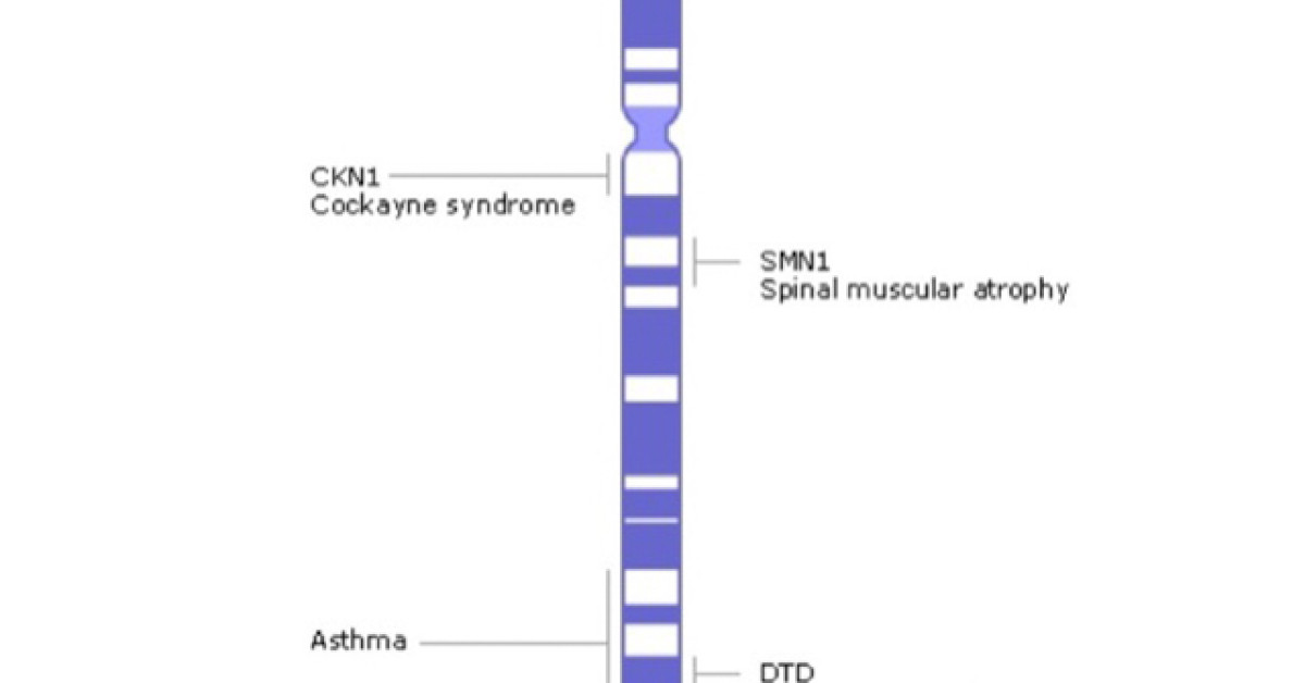 Human chromosome 05 displaying location of Cockayne syndrome A gene image