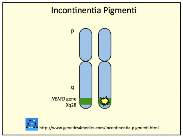 Genetics of Incontinentia pigmenti*