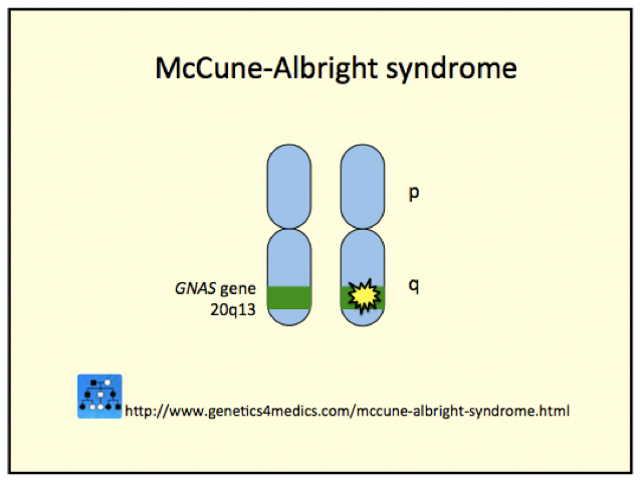 Genetics of McCune–Albright syndrome*
