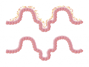 Representation of the intestinal lining with and without microbiota