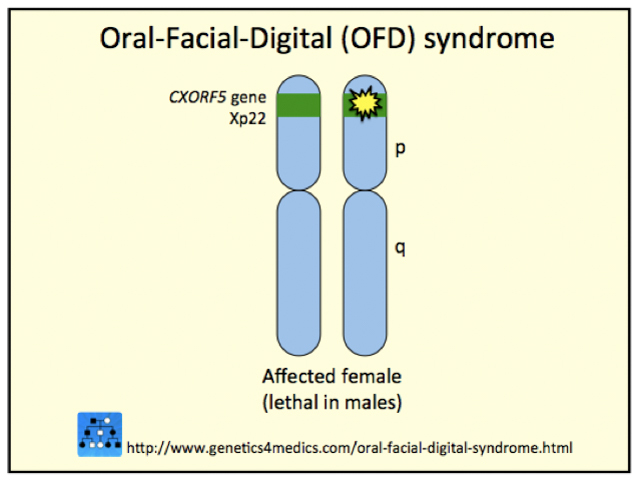 Genetics of Orofaciodigital syndrome type 1*