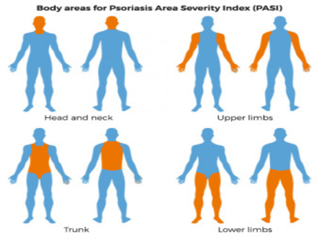 PASI body area