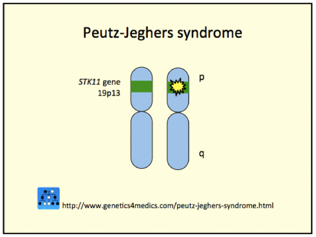 Genetics of Peutz-Jeghers syndrome*