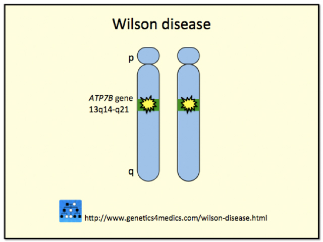 Genetics of Wilson disease*