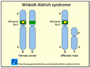 Wiskott Aldrich Syndrome 