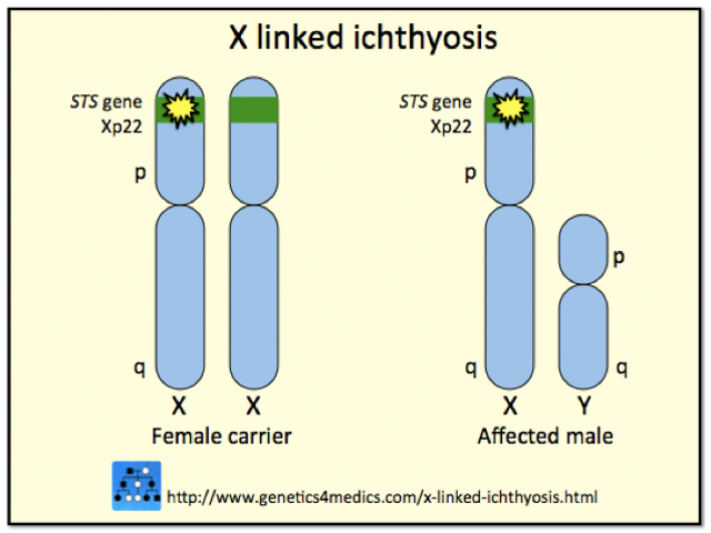 Genetics of X-linked ichthyosis*