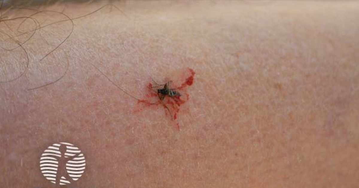 Insect bite image