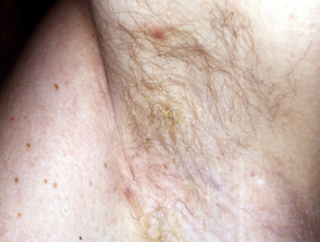 Bush, Brazilian or Somewhere In Between: A Timeline of Pubic Hair Trends