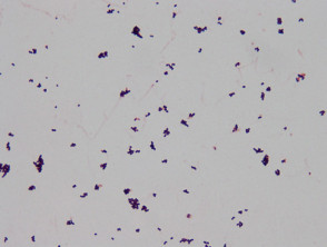 Gram stain of corynebacteria cultured from forearm skin