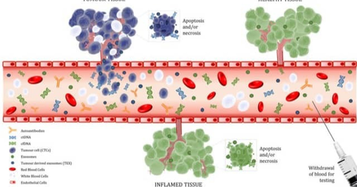 Understanding Local Reactions Protecting Your Bloodstream - fbcxpdn