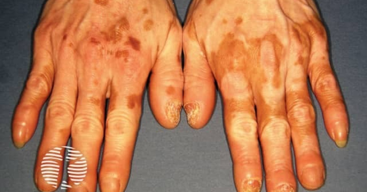 pt141 injection site where to get pt141 PT-141 Peptide Injection Therapy at Home in Dubai pt141 injection site where to get pt141 PT-141 Peptide Injection Therapy at Home in Dubai