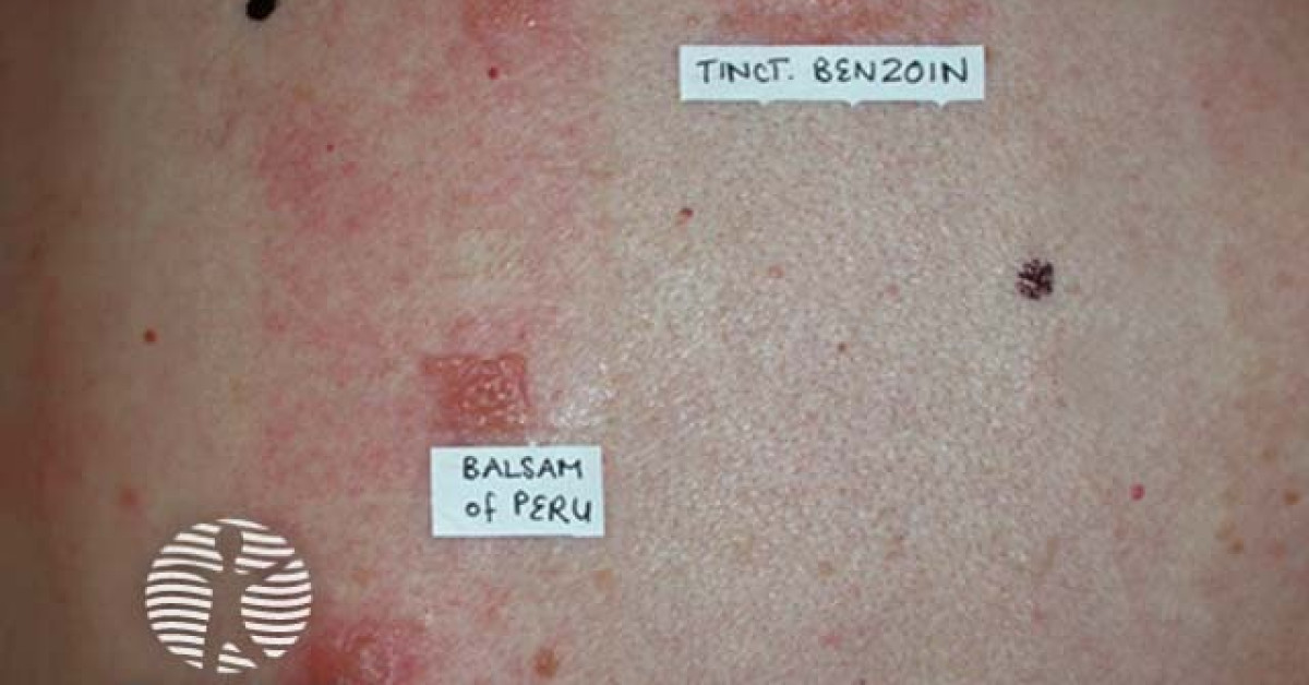 Patch test image