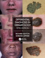 differential diagnosis dermatology richard ashton