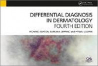 differential diagnosis dermatology richard ashton