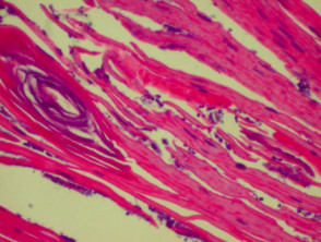 H&E stain of yeasts