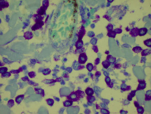 Mast cells stained with toluidine blue